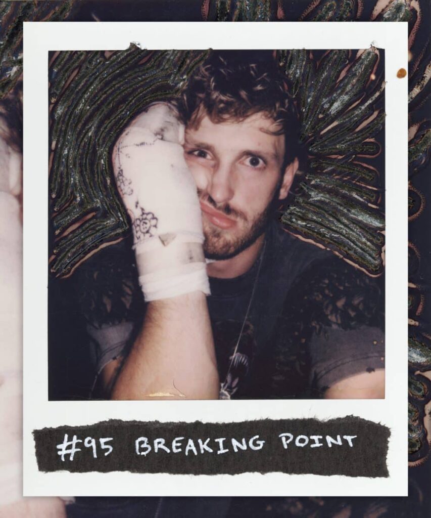 95-BREAKING-POINT-scaled.jpg - Crypto and Coin Logan Paul with a broken hand